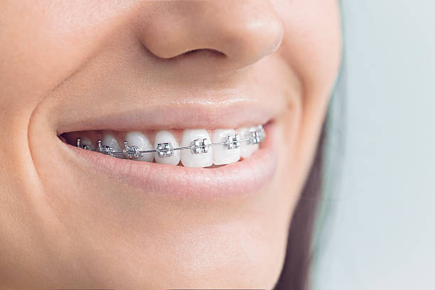 Best Dental Inlays and Onlays  in Sonoma, CA